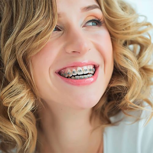 Yetişkinlerde-Ortodonti Yetişkinlerde-Ortodonti