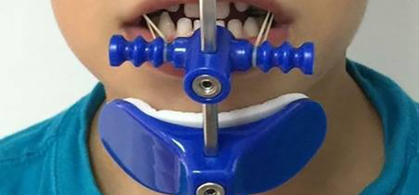 cem-irezli-cene-ve-yuz-duzeltme-gorseli cem-irezli-cene-ve-yuz-duzeltme-gorseli